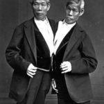 Sziámi ikrek: Chang és Eng, a Sziámban született ikerpár